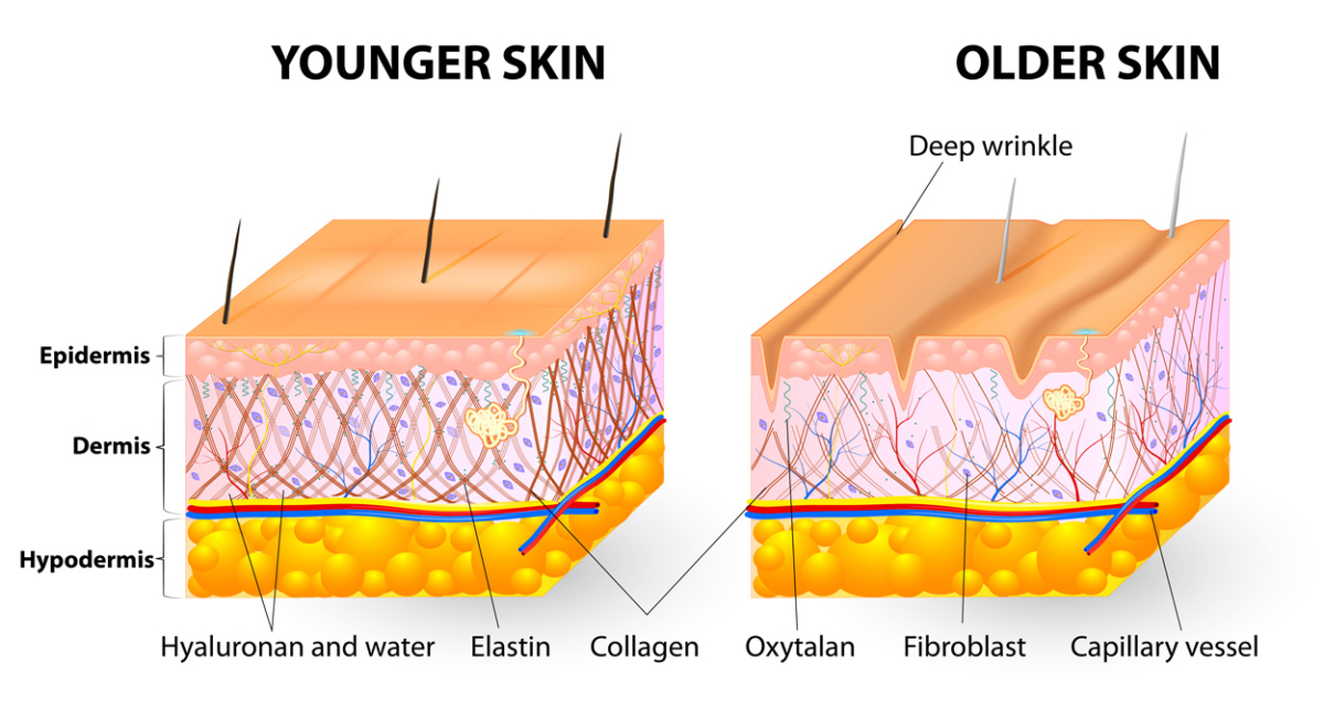 juvederm-volite juvederm-volite