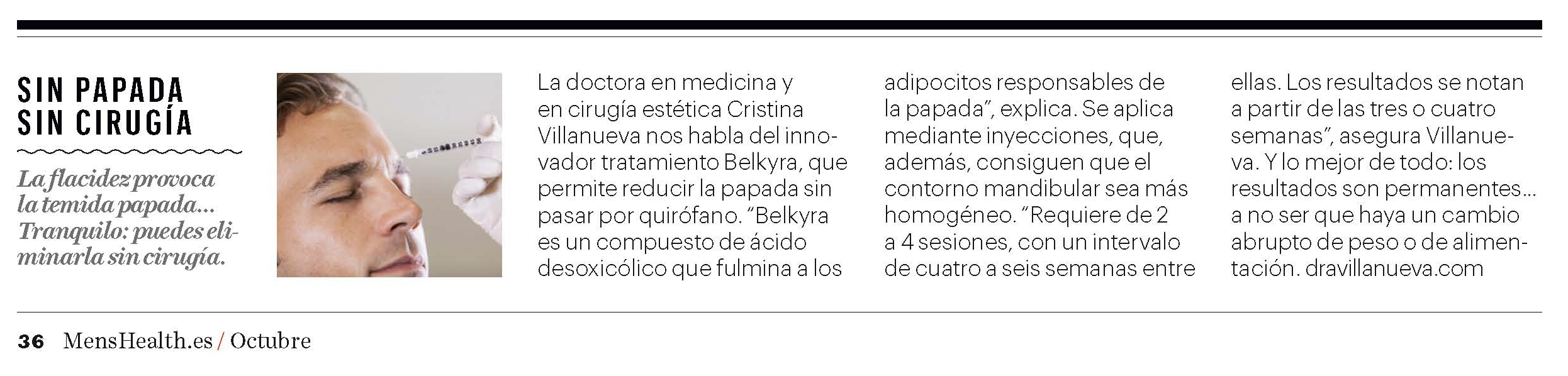 sin papada sin cirugia